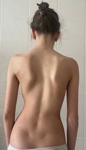 After